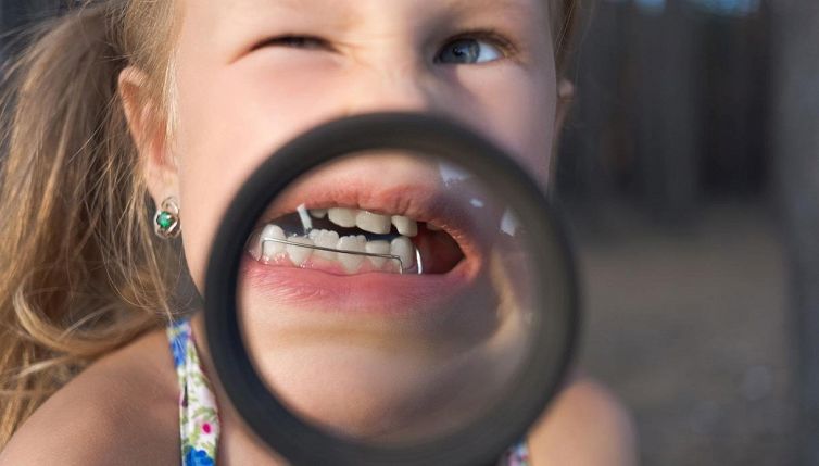 Tuo figlio porta l'apparecchio ai denti? Colpa di tuo marito
