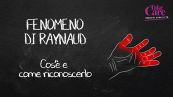 Cos'è e come riconoscere il fenomeno di Raynaud