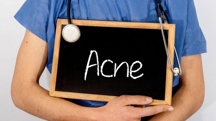 Cos’è l’acne "inspiegabile" e cosa la provoca