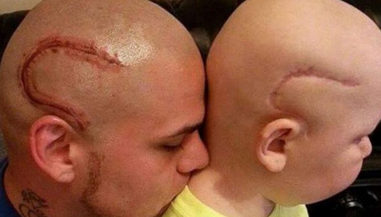 Si tatua cicatrice come quella del figlio, papà commuove il web