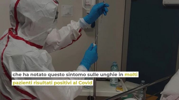 Covid, nuovo sintomo: unghie dall'aspetto strano