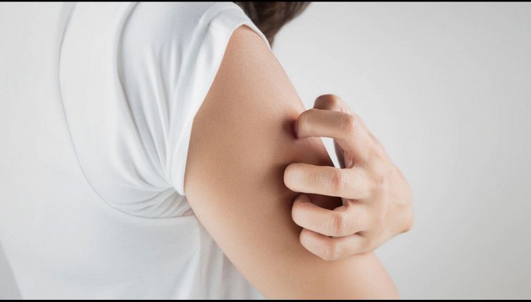 Psoriasi, come riconoscerla e affrontarla