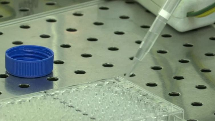 Lotta a Sla, forse la chiave e' carenza di un enzima