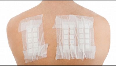 Patch test: a cosa serve e come funziona