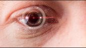 La lente a contatto che cura il glaucoma