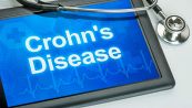 Morbo di Crohn: cos'è, i sintomi e la terapia