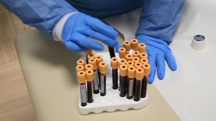 Sangue, donazioni in ripresa ma ancora lontani i livelli pre-Covid