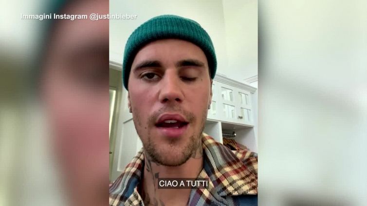 Justin Bieber con mezzo volto paralizzato: "Ho la sindrome di Ramsay Hunt"