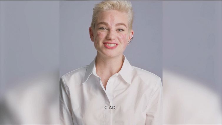 Bebe Vio, nuova ambasciatrice di L’Oréal Paris