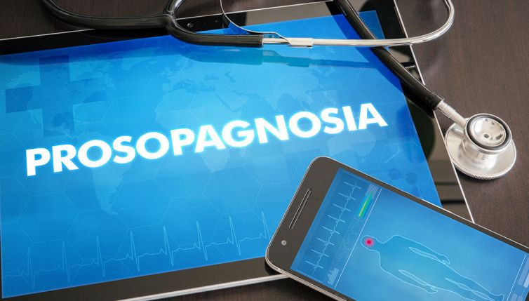 Cos'è la prosopagnosia: cause, sintomi e terapie