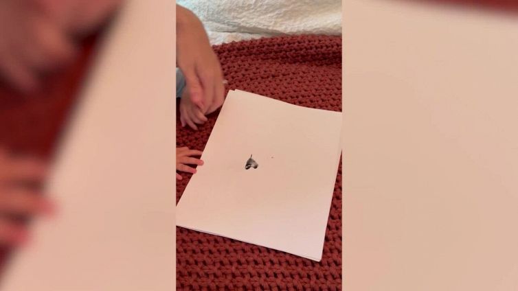 Nasce con una anomalia genetica che la rende unica