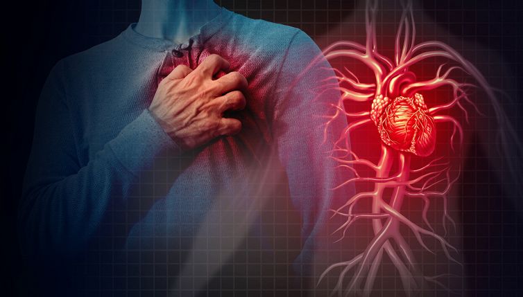 Infarto, gruppo sanguigno più a rischio per attacco di cuore