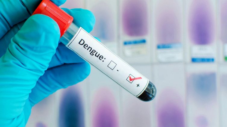 Cos'è la febbre dengue, da cosa è causata e quali sono i sintomi