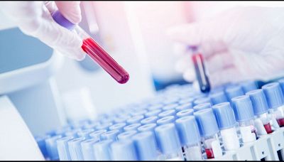 Un test del sangue contro il cancro: la scoperta scientifica