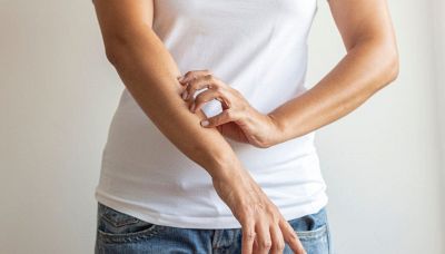 Cos'è la scabbia, i sintomi e la diffusione in Italia