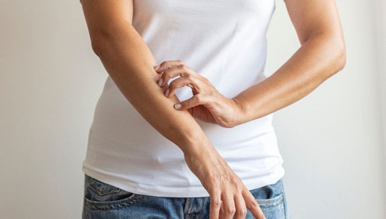 Cos'è la scabbia, i sintomi e la diffusione in Italia