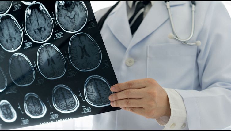 Scoperto l'antivirus del cervello: come funziona