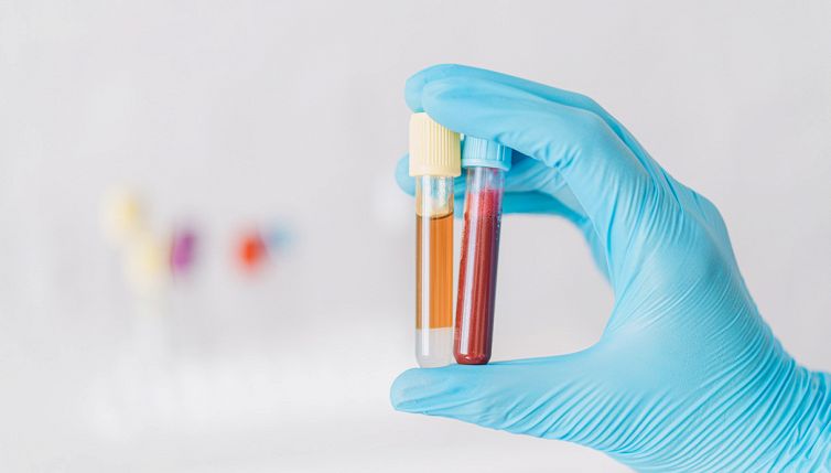 È il farmaco più costoso al mondo: ecco cosa cura