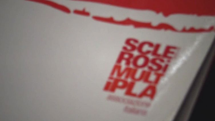 Staminali del cervello rallentano sclerosi multipla