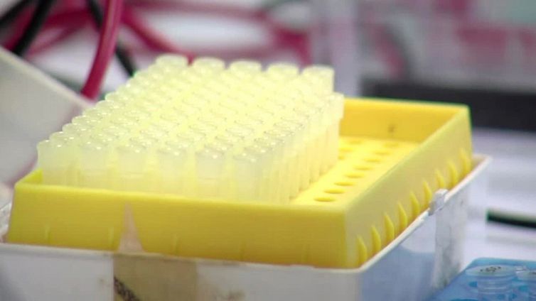 Scoperto un nuovo gene responsabile dell'autismo