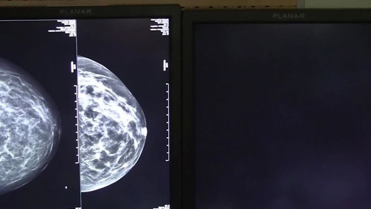 Torna a salire la spesa privata per le cure: +9% nel 2021