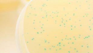 Scoperto un nuovo virus