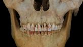 La Principessa Rossa con i denti colorati, la misteriosa scoperta