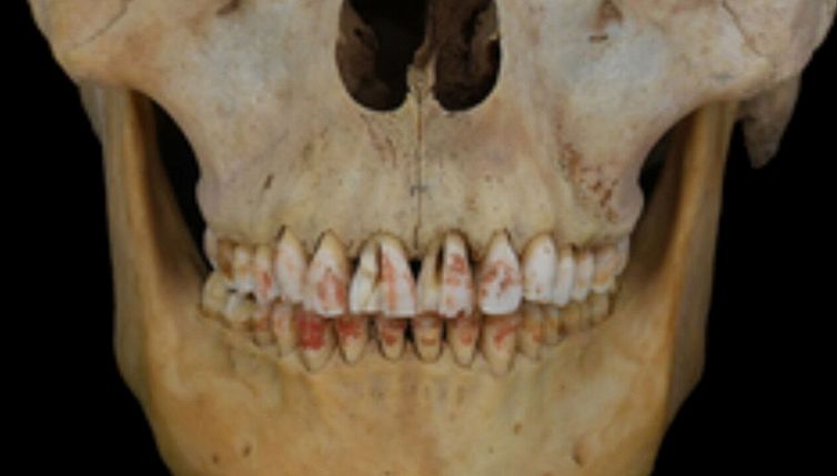 La Principessa Rossa con i denti colorati, la misteriosa scoperta