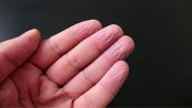 Perché le dita raggrinziscono in acqua: c'entra l’evoluzione