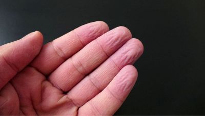 Perché le dita raggrinziscono in acqua: c'entra l’evoluzione