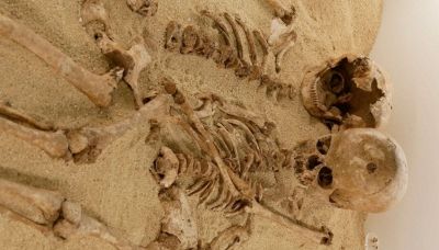 Scoperto in Italia il DNA di un'antica malattia genetica