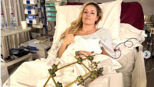 Il dramma di Lindsey Vonn: cos'è l'impalcatura sulla sua gamba