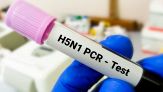 Influenza aviaria H5N1, primo caso di contagio da gatto a uomo