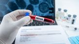 Vaiolo delle scimmie, l'Oms proroga l'emergenza: casi di Mpox anche in Italia