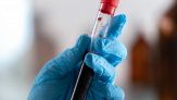 Analisi del sangue, il digiuno serve ancora? La risposta della scienza