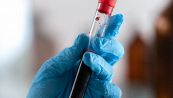Analisi del sangue, il digiuno serve ancora? La risposta della scienza