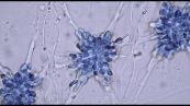Tumori pediatrici, farmaco made in Italy di Biogenera lancia sfida