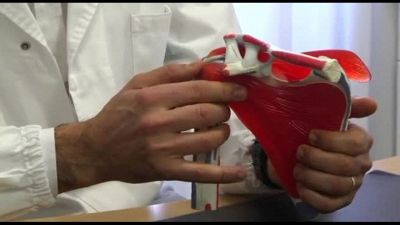Nuove terapie per la spalla, dal patch rigenerativo alle protesi
