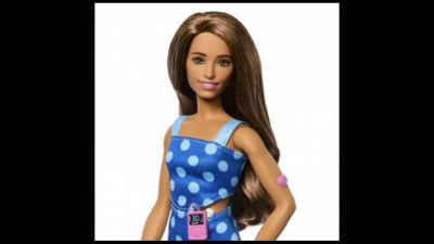 Arriva Barbie con il diabete di tipo 1, monitora glicemia e insulina