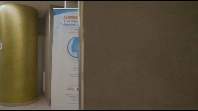 L'alopecia areata, un corso a Roma sulle novità terapeutiche