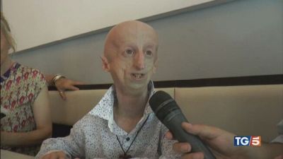 Addio a Sammy Basso la forza e il coraggio
