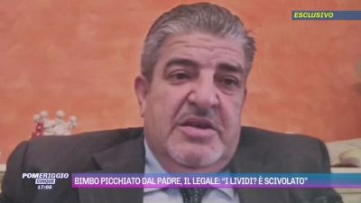 Bimbo picchiato dal padre, il legale: "I lividi? È scivolato"