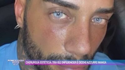 Chirurgia estetica: tra gli influencer è occhi azzurri mania