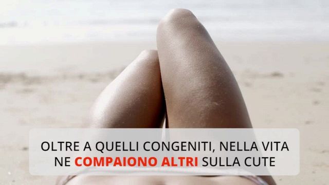 A Che Eta Escono I Nei Cosa sono e perché escono i nei?