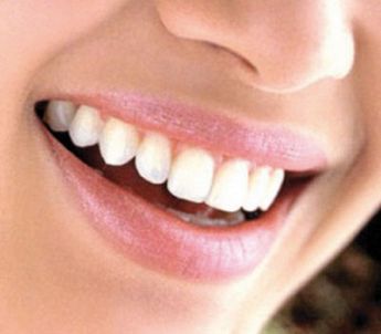 Studio Dentistico Medico Chirurgo Albertazzi  estetica dentale