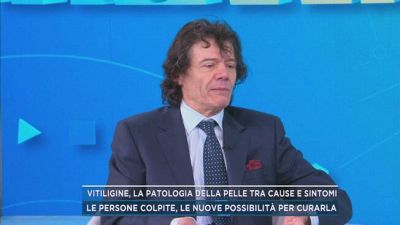 Vitiligine, la patologia della pelle tra cause e sintomi