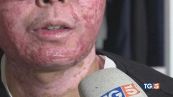 "La mia vita rovinata in quei trenta secondi"