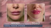 Labbra, come averle sempre perfette