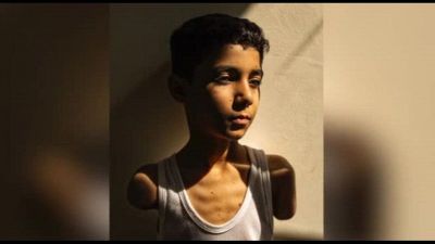 World Press Photo, un bambino mutilato a Gaza è la foto dell'anno