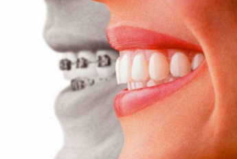 RIILI DR. PAOLO STUDIO DENTISTICO-Estetica dentale